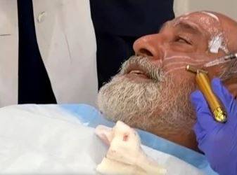 محمد احمد کا فیس ٹریٹمنٹ، نئی ویڈیو نے مداحوں کی توجہ حاصل کرلی